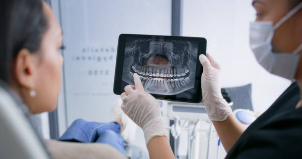 Licensed Tooth Extraction service in Derwood, MD - Smile Center Dentistry